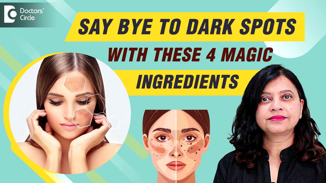 Pigmentation | Say Bye to DARK SPOTS on Face with 4 Magic Ingredients 