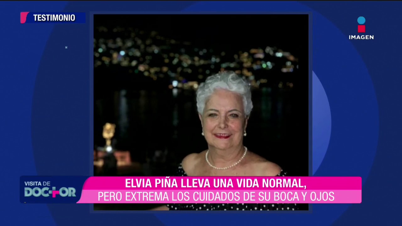 ¿Cómo es vivir con el síndrome de Sjögren? El testimonio de Elvia Piña | Visita de Doctor