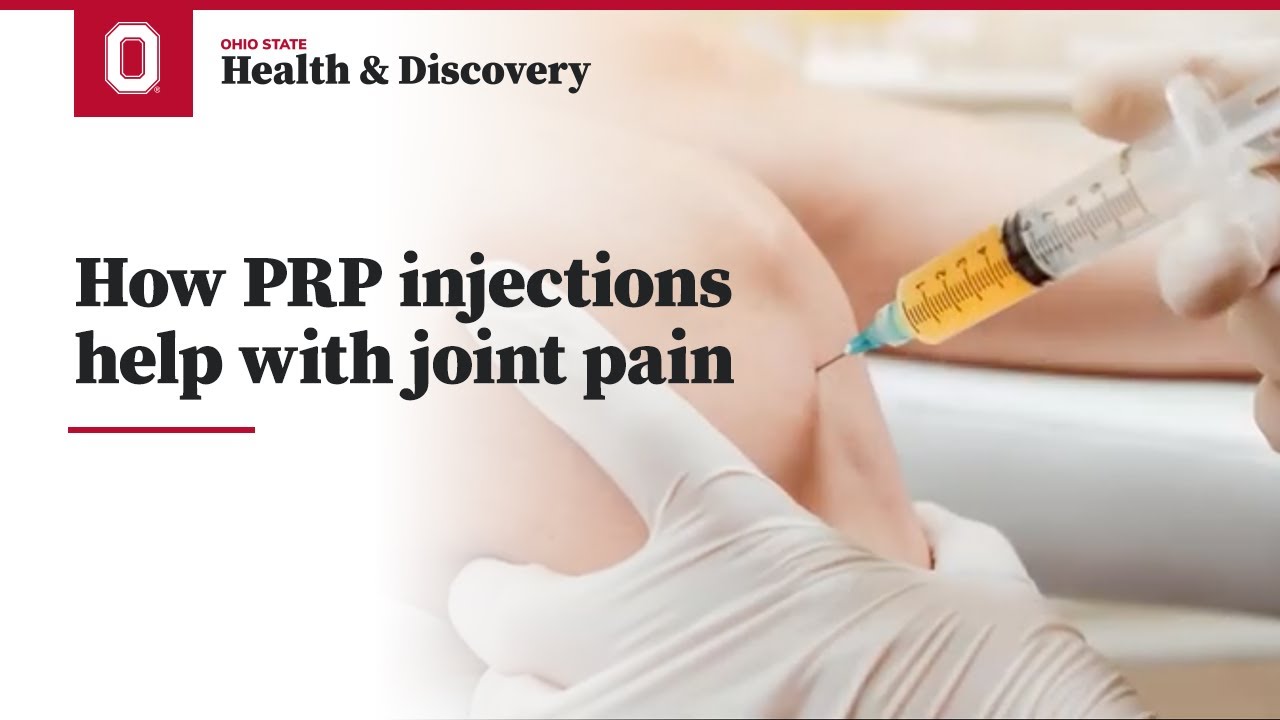 How PRP injections help with joint pain | Ohio State Medical Center