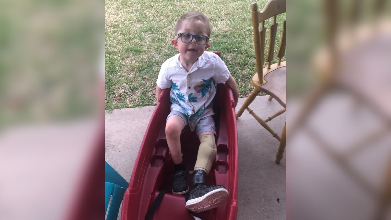 Public pays for new prosthetic leg after 9-year-old loses his at beach during Galveston vacation