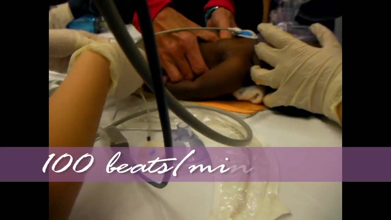 Infant CPR Video