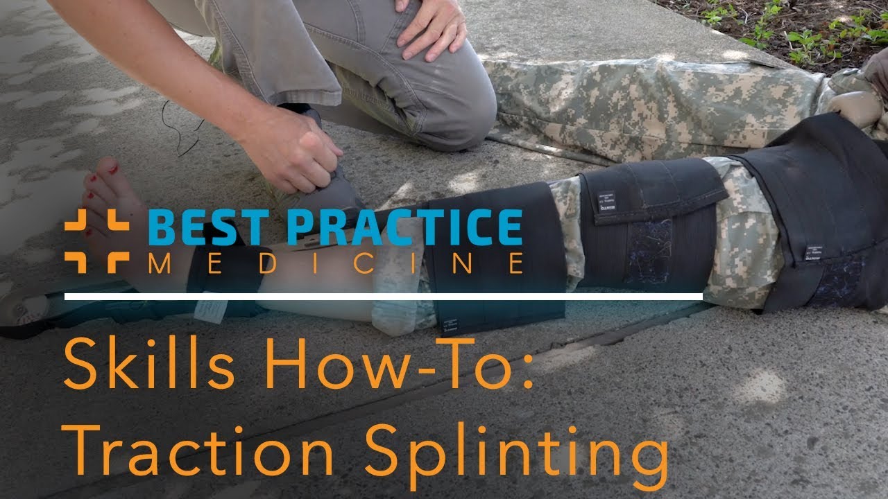 NREMT Skills Sheet: Traction Splinting