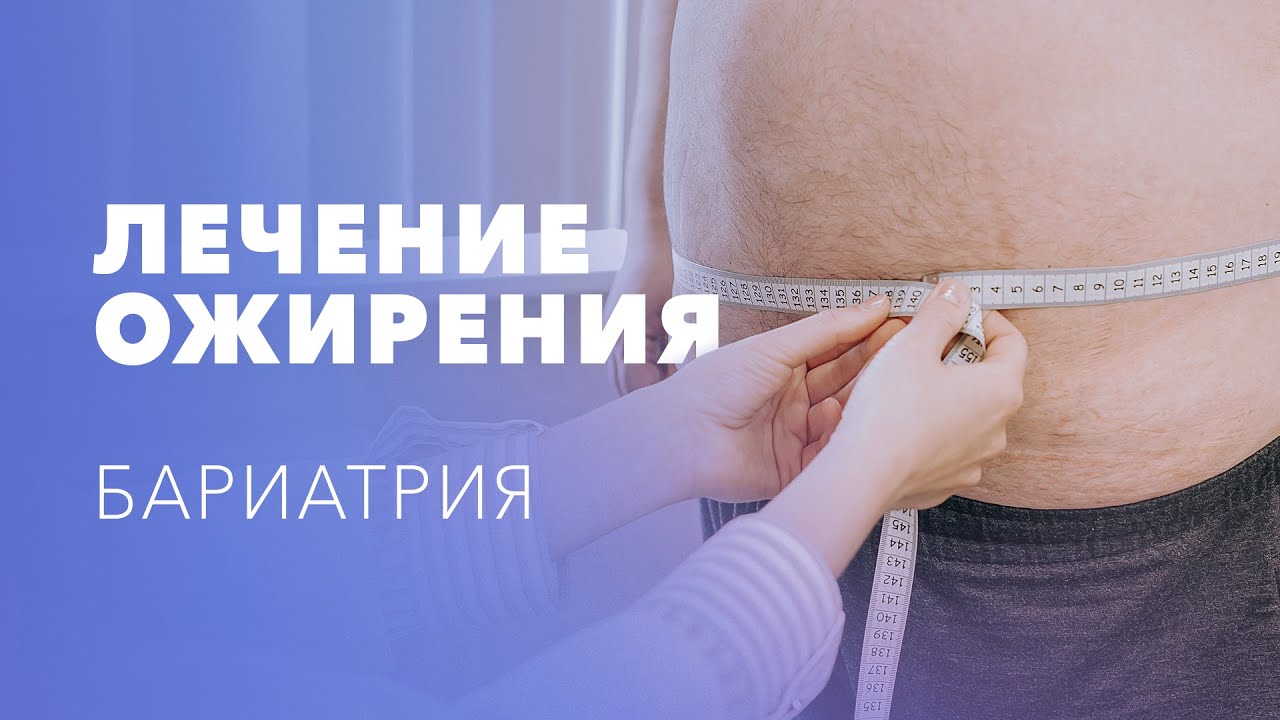 Опасность ожирения, причины. Лечение ожирения. Бариатрические операции: виды и особенности