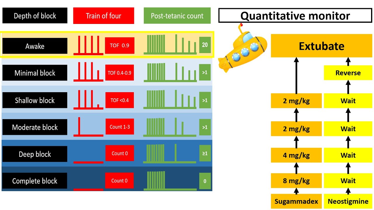 Residual Neuromuscular block: has this nightmare reached an end?