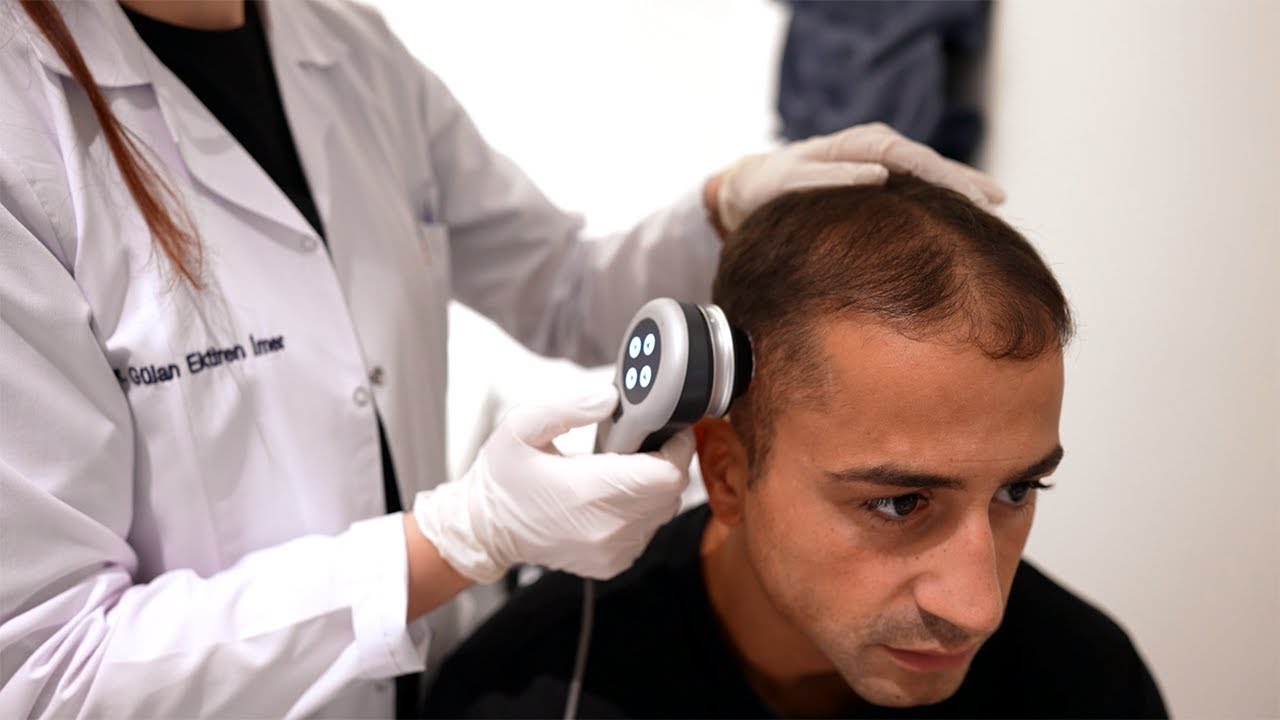 Système Elithair Pre-Test : une préparation optimale de votre greffe de cheveux en 6 étapes
