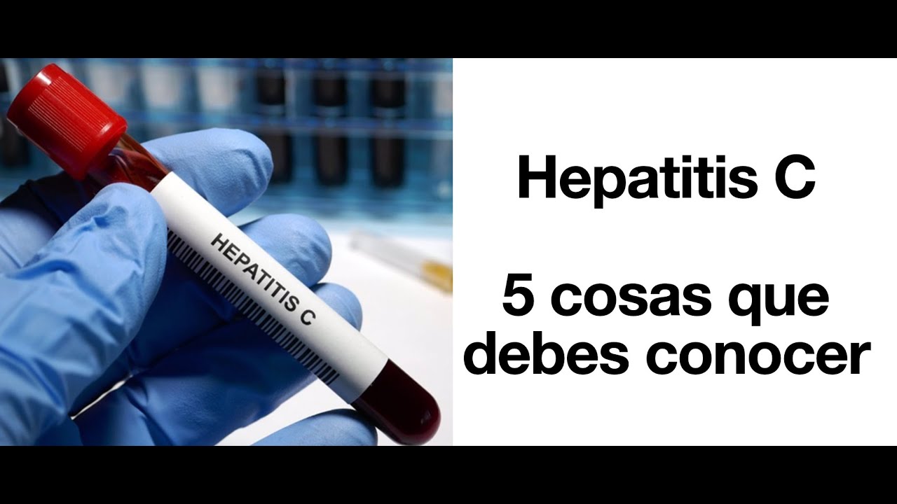 Virus de Hepatitis C: 5 cosas que debes saber - VHC