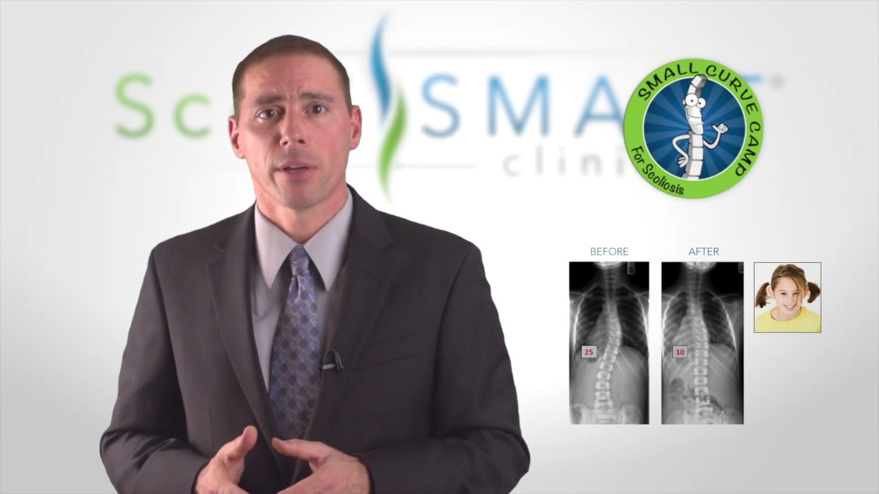 Small Curve Camp For Mild Scoliosis. #MildScoliosis #scolismart #scoliosistreatment #scolis