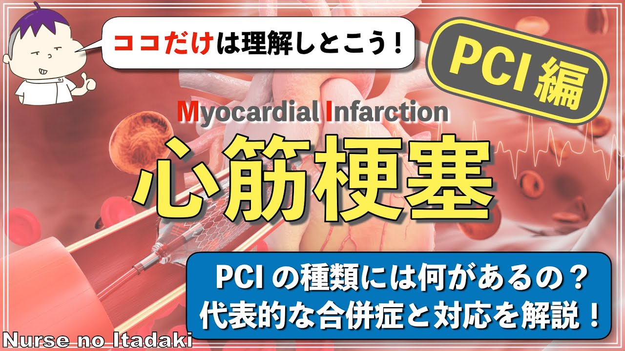 【PCIのココだけ理解しとこう！】心筋梗塞におけるPCI治療の種類､代表的な合併症と対応を学ぼう！