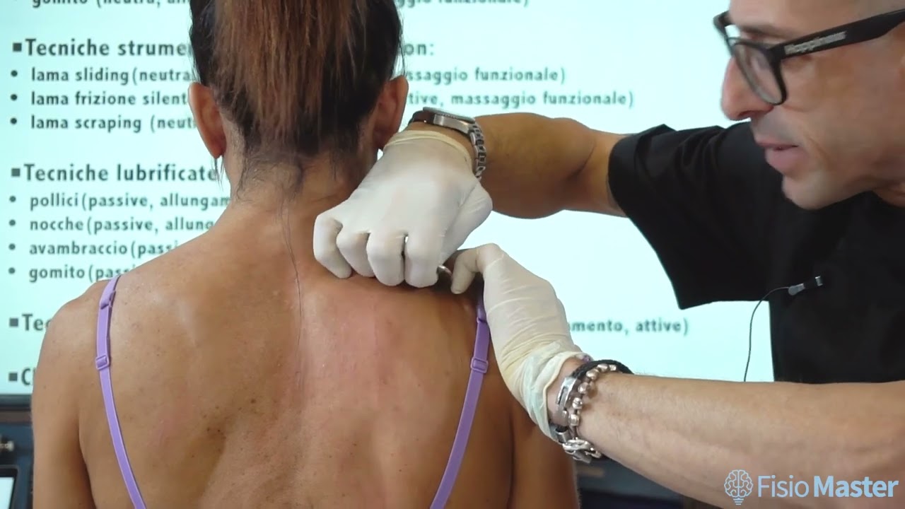 Scraping del Trapezio Superiore con IASTM