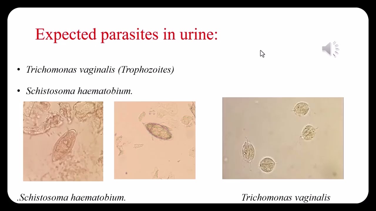 Types of specimens for diagnosis of parasites