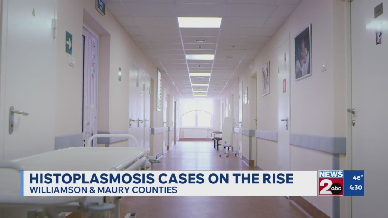 Histoplasmosis cases on the rise in Williamson and Maury counties