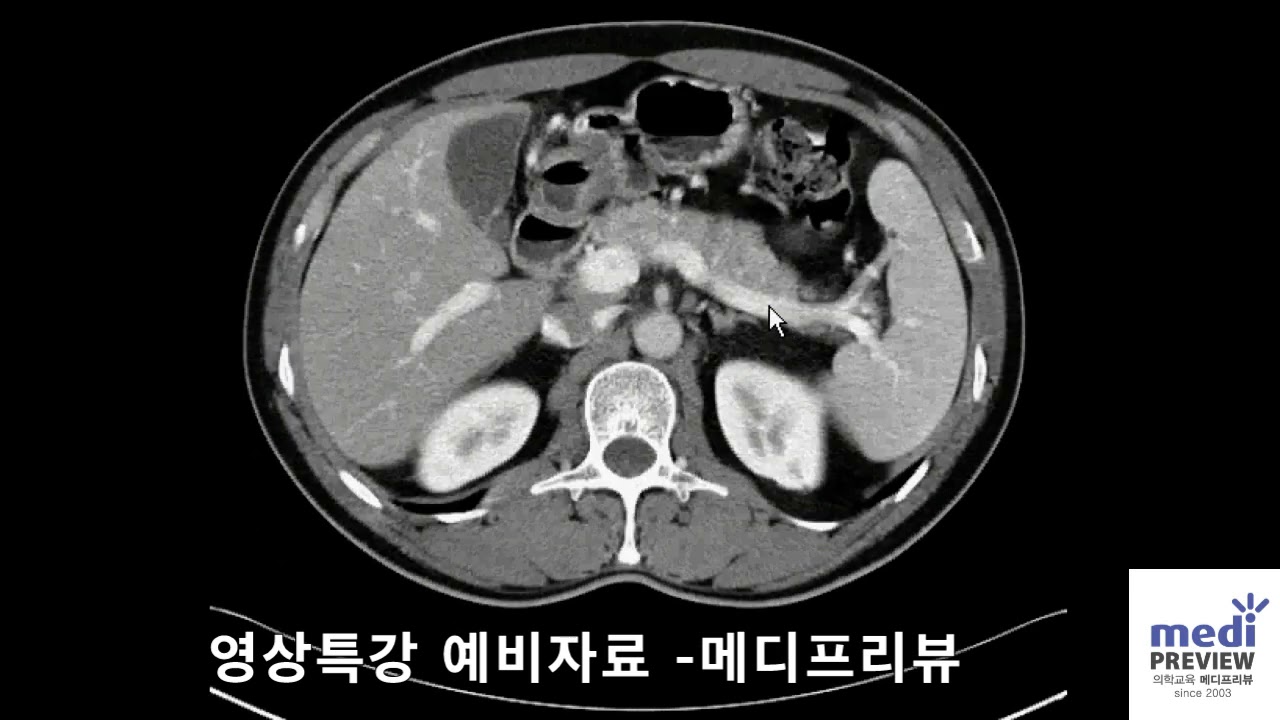 영상의학 특강 예비자료2 - Abdomen CT2   #영상의학 #의사국가고시 #의사국시 #메디프리뷰