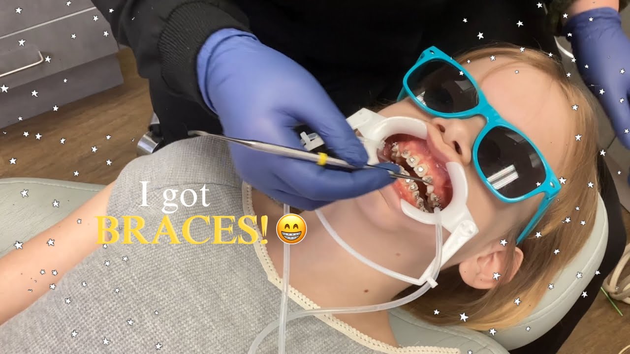 I got BRACES! // Annika’z life