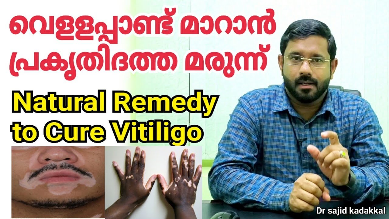 Natural Remedy to Cure Vitiligo, വെളളപ്പാണ്ട് മാറാൻ ഫലപ്രദമായ പ്രകൃതിദത്ത മരുന്ന് പരിചയപ്പെടാം
