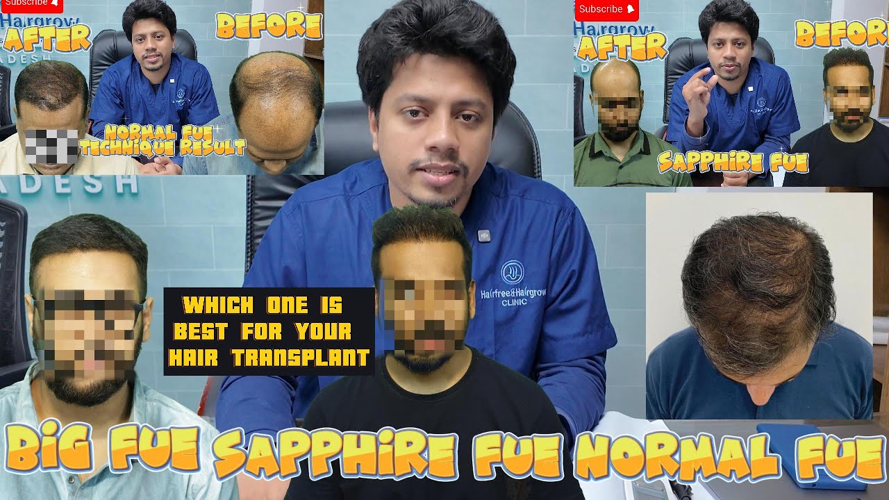 HAIR TRANSPLANT COST. HAIR FALL SOLUTION. HAIR STYLE. HAIR TRANSPLANT. HAIR TREATMENT.