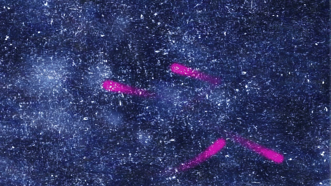 TEED - A Dream I Have