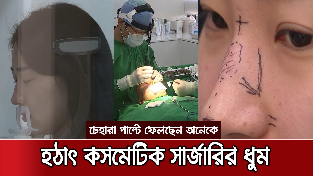 সার্জারি করে চেহারা পাল্টে ফেলছেন অনেকে, কিন্তু কেন? | Plastic surgery