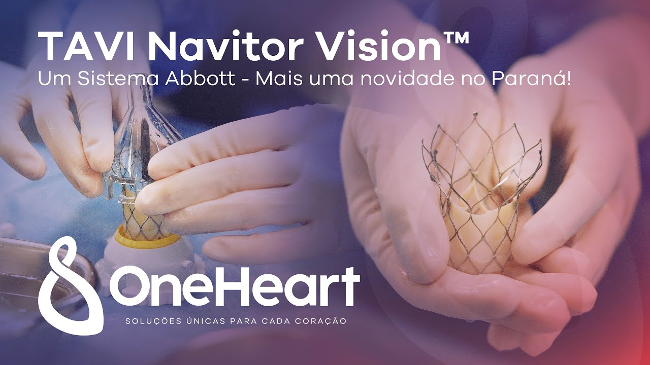 Novidade no Paran&aacute;! TAVI Navitor Vision&trade; realizada pela OneHeart!