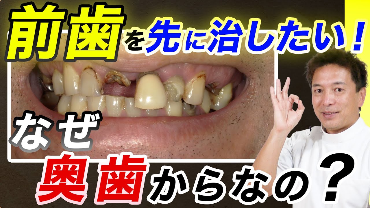 【前歯でお困りの方へ】前歯から先に治せます【写真で解説】