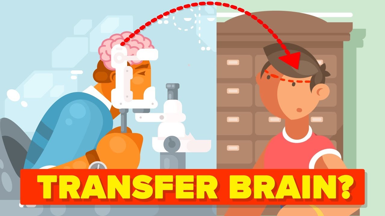 Why Can't We Transplant Brains?