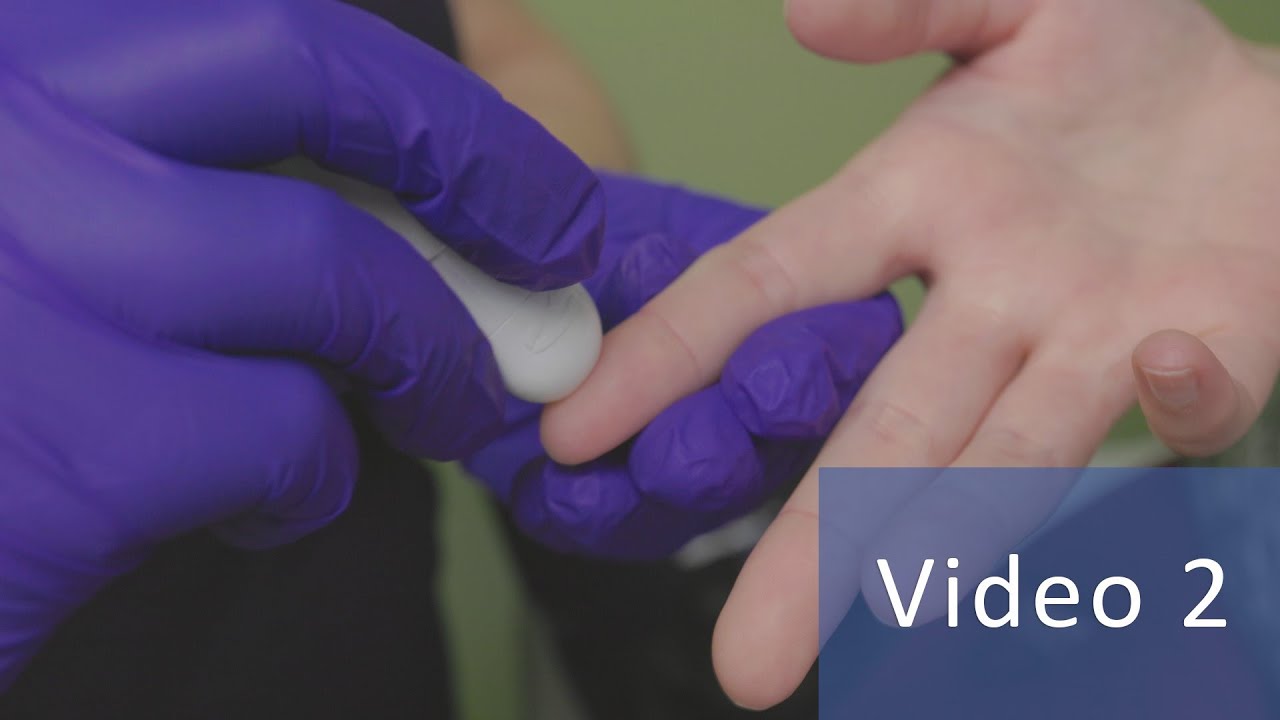 Blood Glucose Testing and Log Sheets | Managing Childhood Diabetes