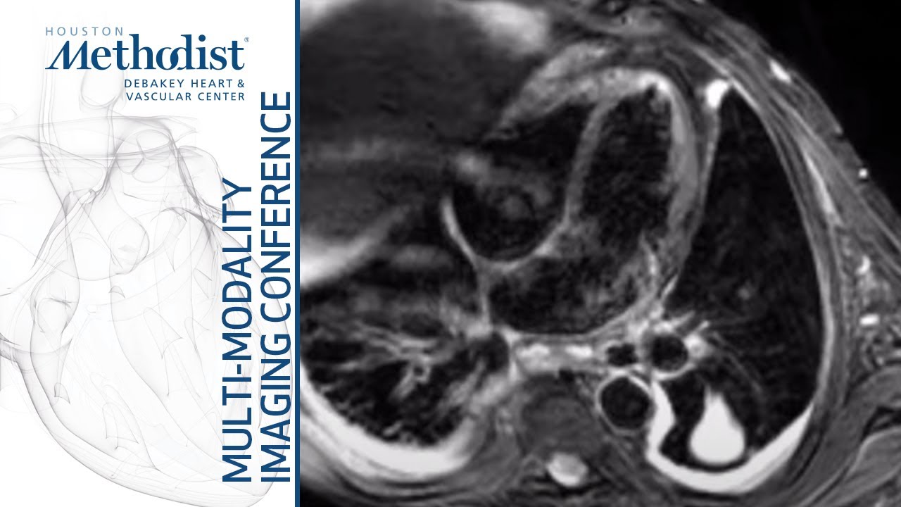 Multi-Modality Case Presentations: by Advanced CV Imaging Fellows (Dipan J. Shah, MD) May 25, 2021