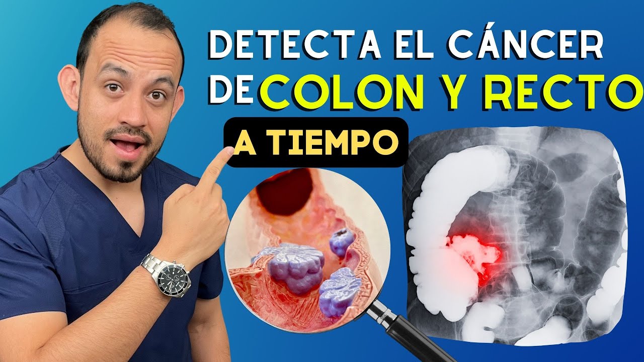 Estudios para DETECTAR el Cáncer de Colon y Recto (Tamizaje) 2025