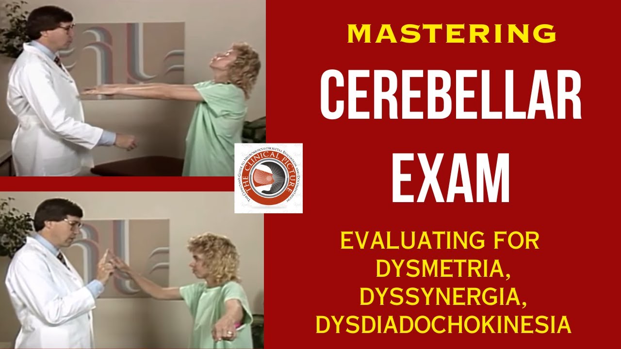 Mastering The Cerebellar Exam - Evaluating for Dysmetria, Dyssynergia, Dysdiadochokinesia