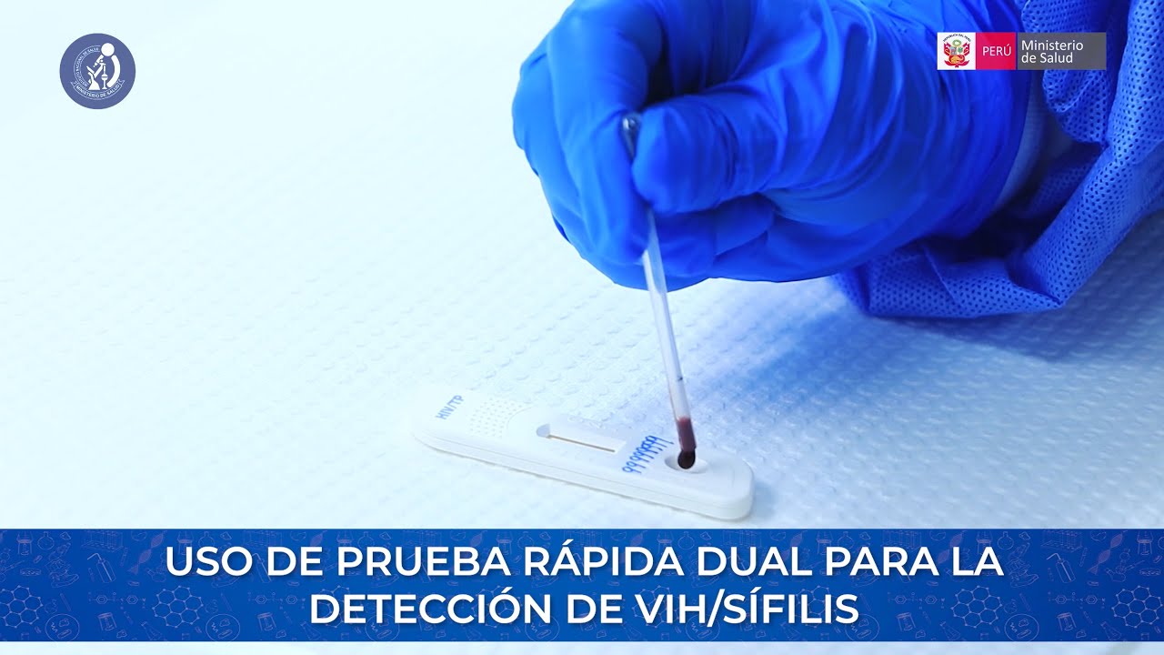 Procedimiento para el uso de la prueba rápida dual en el diagnóstico de VIH y Sífilis