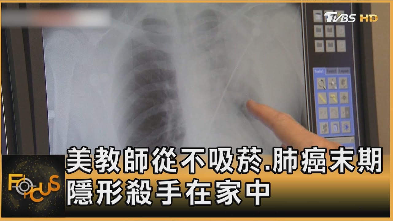 美教師從不吸菸.肺癌末期 隱形殺手在家中｜方念華｜FOCUS全球新聞 20240416@tvbsfocus
