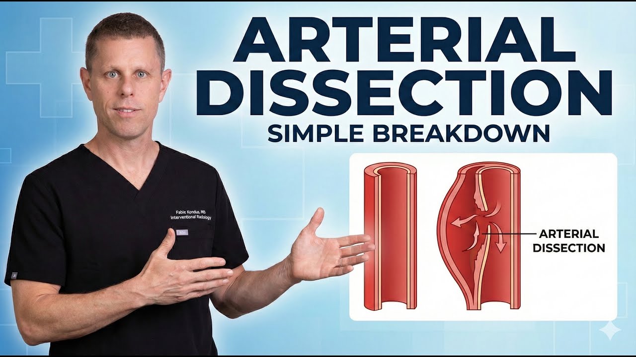 The Blood Vessel Tear That Can Kill In Minutes&mdash;Know the Signs!
