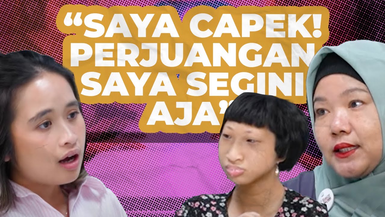 SECKEL SYNDROME, KONDISI LANGKA HANYA ADA 6 DI INDONESIA! | #GritteBukaPraktek