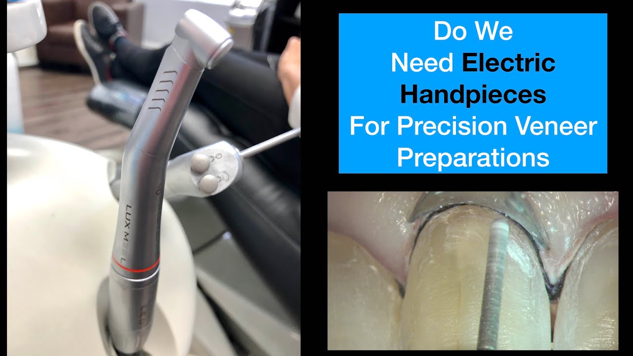 Porcelain Veneer Preparations. How critical are electric handpieces for precision preparations?