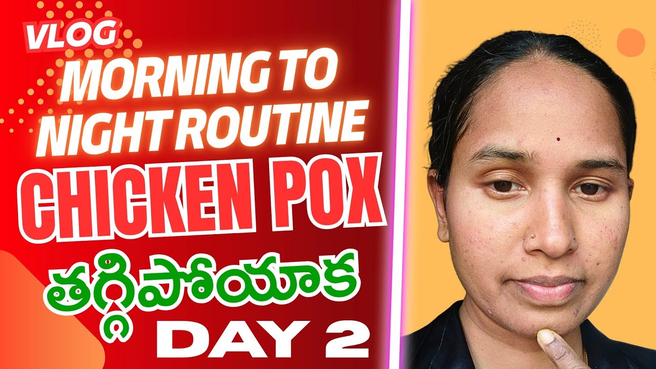 Chicken Pox తగ్గిపోయాక! Morning to Night Routine - Day 2 Vlog