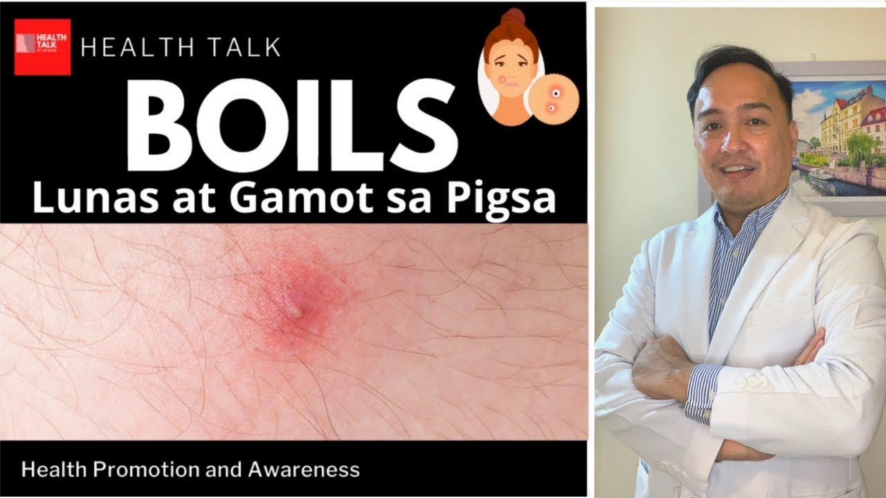 Boils (Pigsa): Causes, Symptoms, Treatment and Prevention