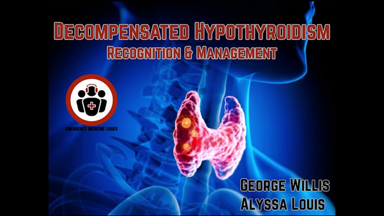 Ep 210 Decompensated Hypothyroidism Recognition and Management