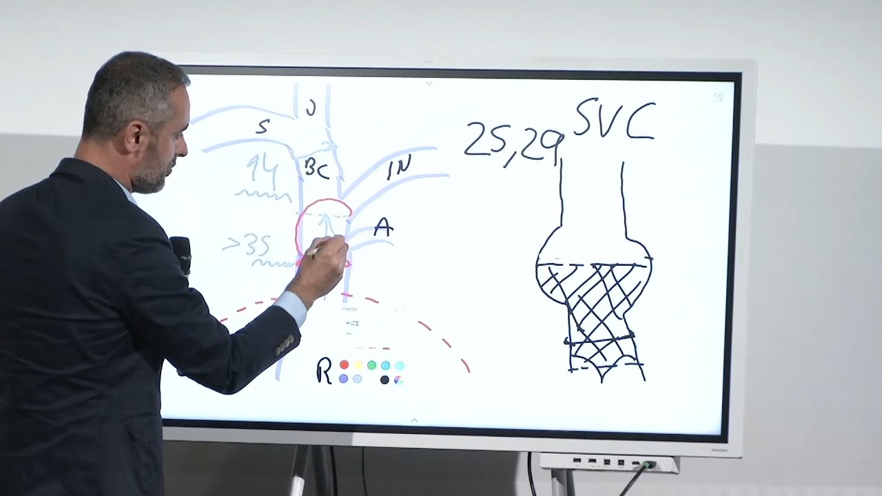 Heterotopic tricuspid valves: to who, when and how? - EuroPCR 2024