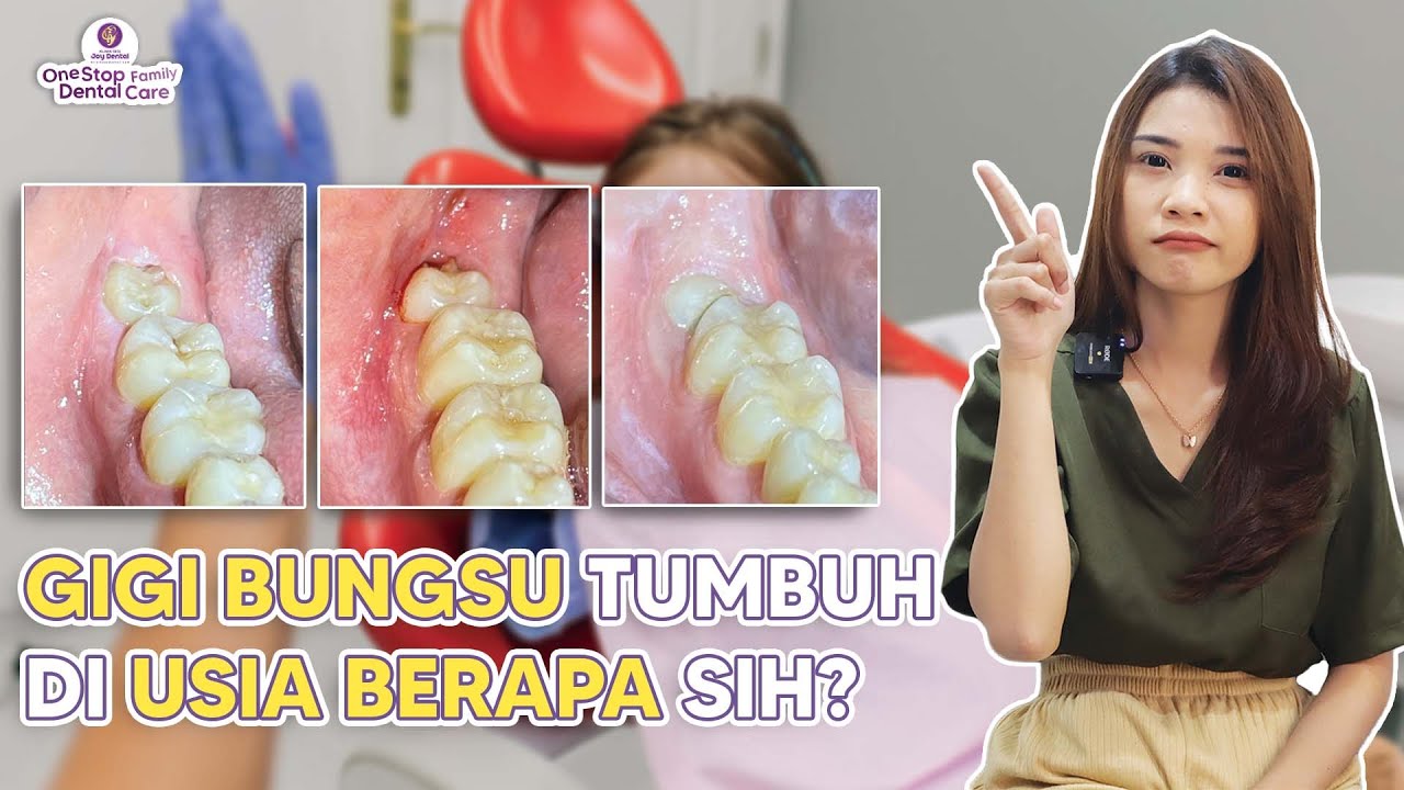 JADI TAU! TERNYATA INI USIA TUMBUH GIGI BUNGSU