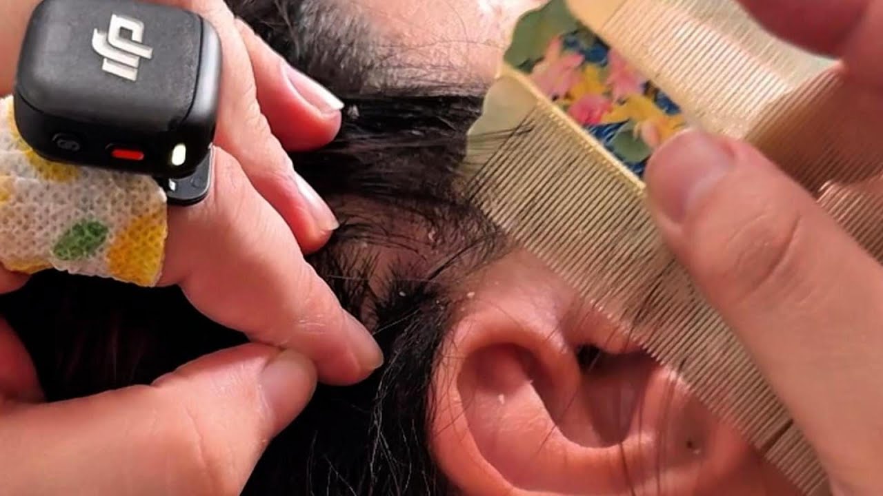 Jojo ASMR | Fine Comb Scalp Massage for Sleep and Stress Relief