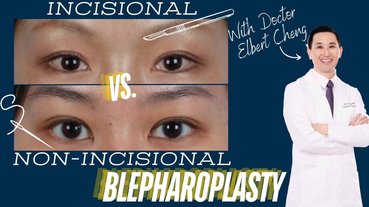 Incisional vs. Non-Incisional Blepharoplasty with Dr. Elbert Cheng