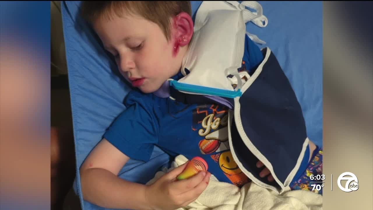 4-year-old boy injured by golf cart at St. Clair Shores Memorial Day parade