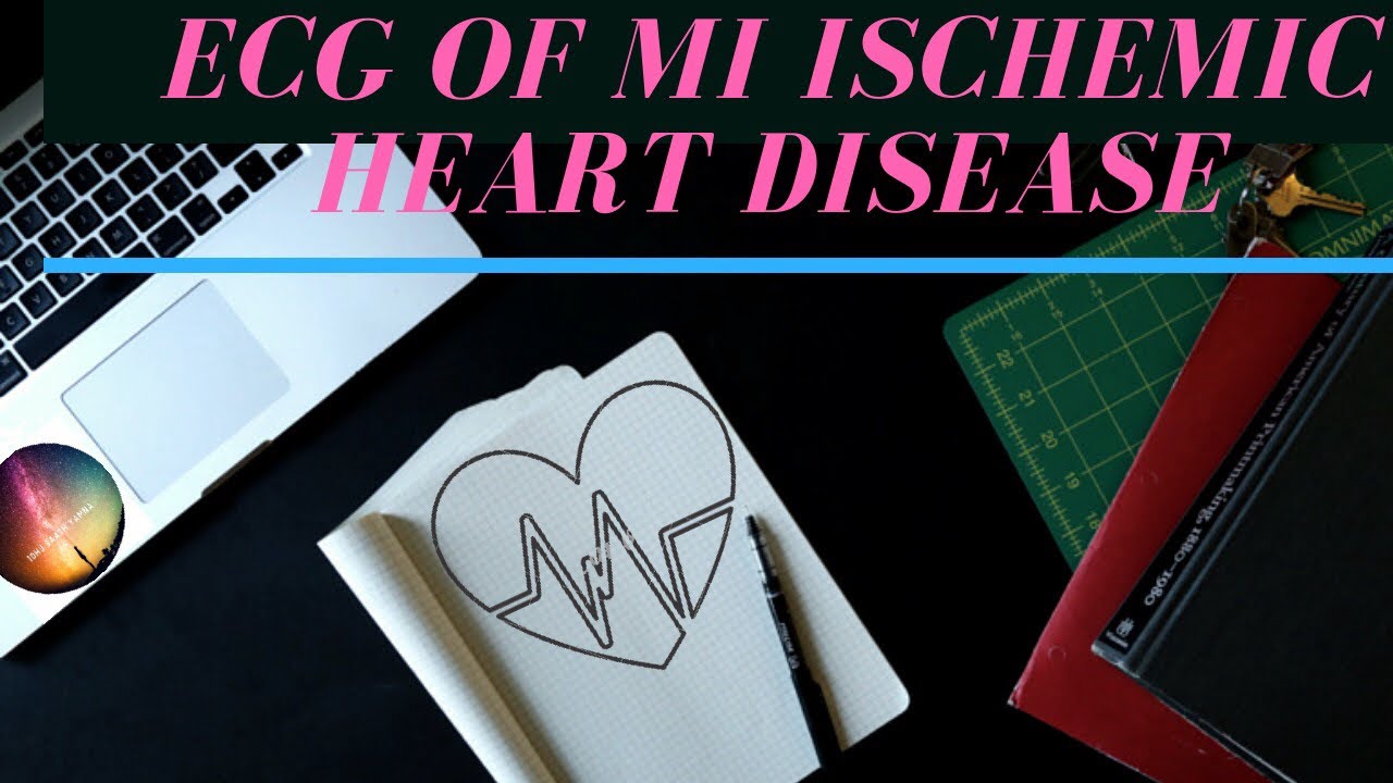 Myocardial infarction ECG | ISAAT VOL-4