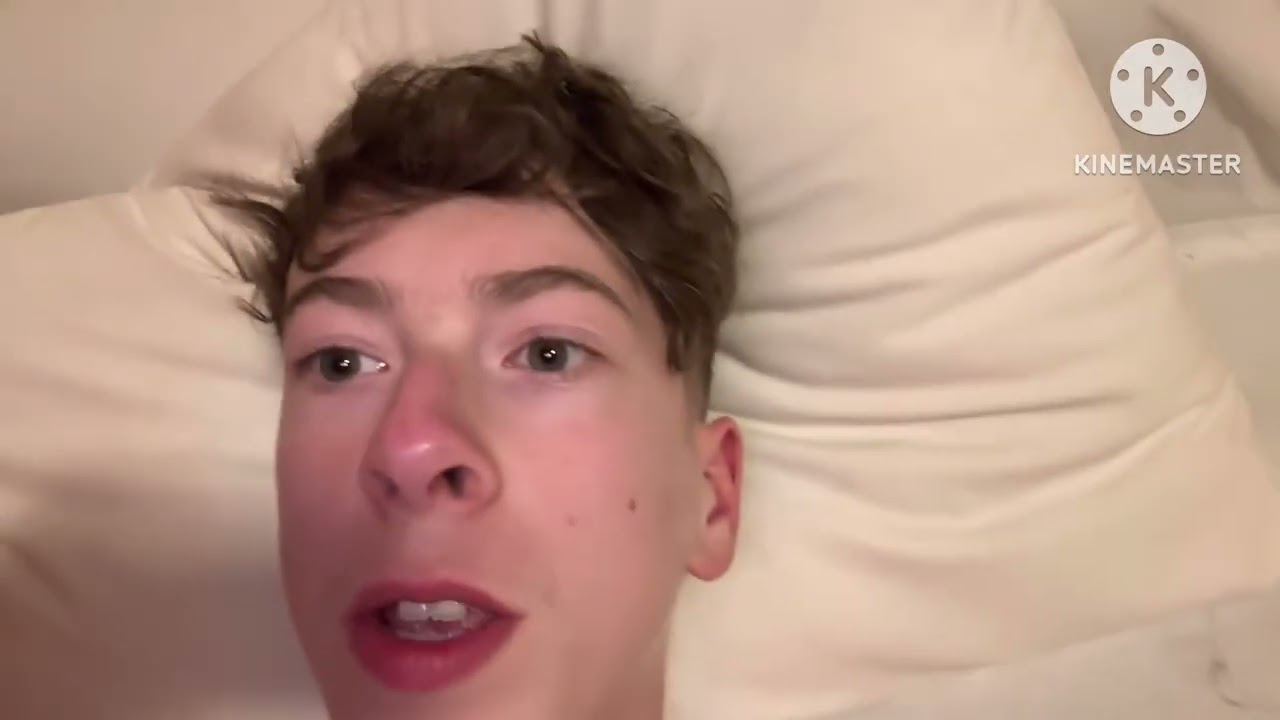I got a sunburn on holiday (vlog part 3)