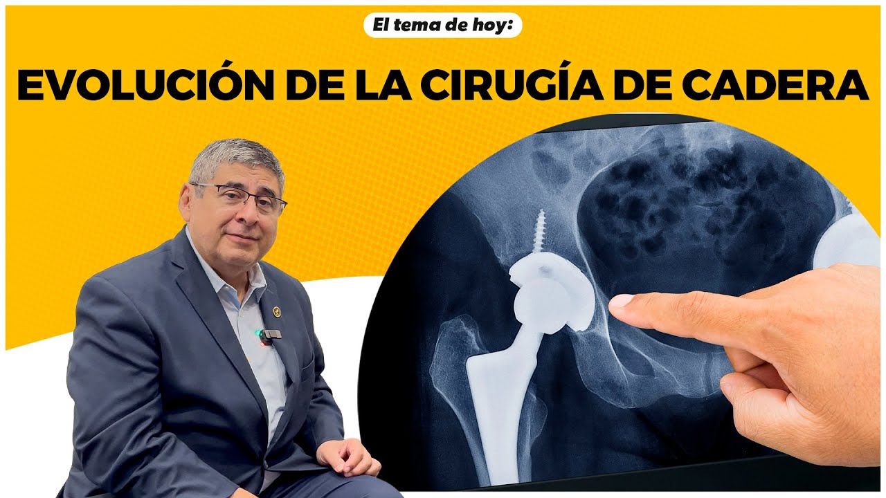 Especial: Evolución Cirugía de Cadera - Dr. Felipe Gómez García.