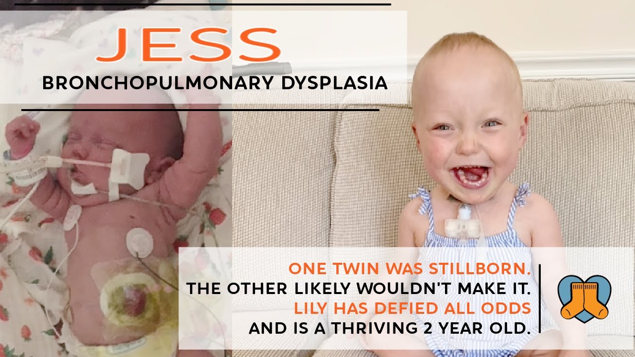 Jess: Bronchopulmonary Dysplasia