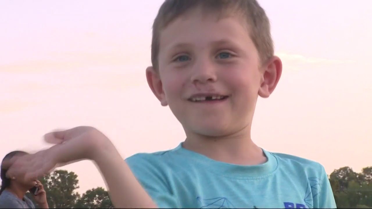 Family searches for dog that attacked 6-year-old boy