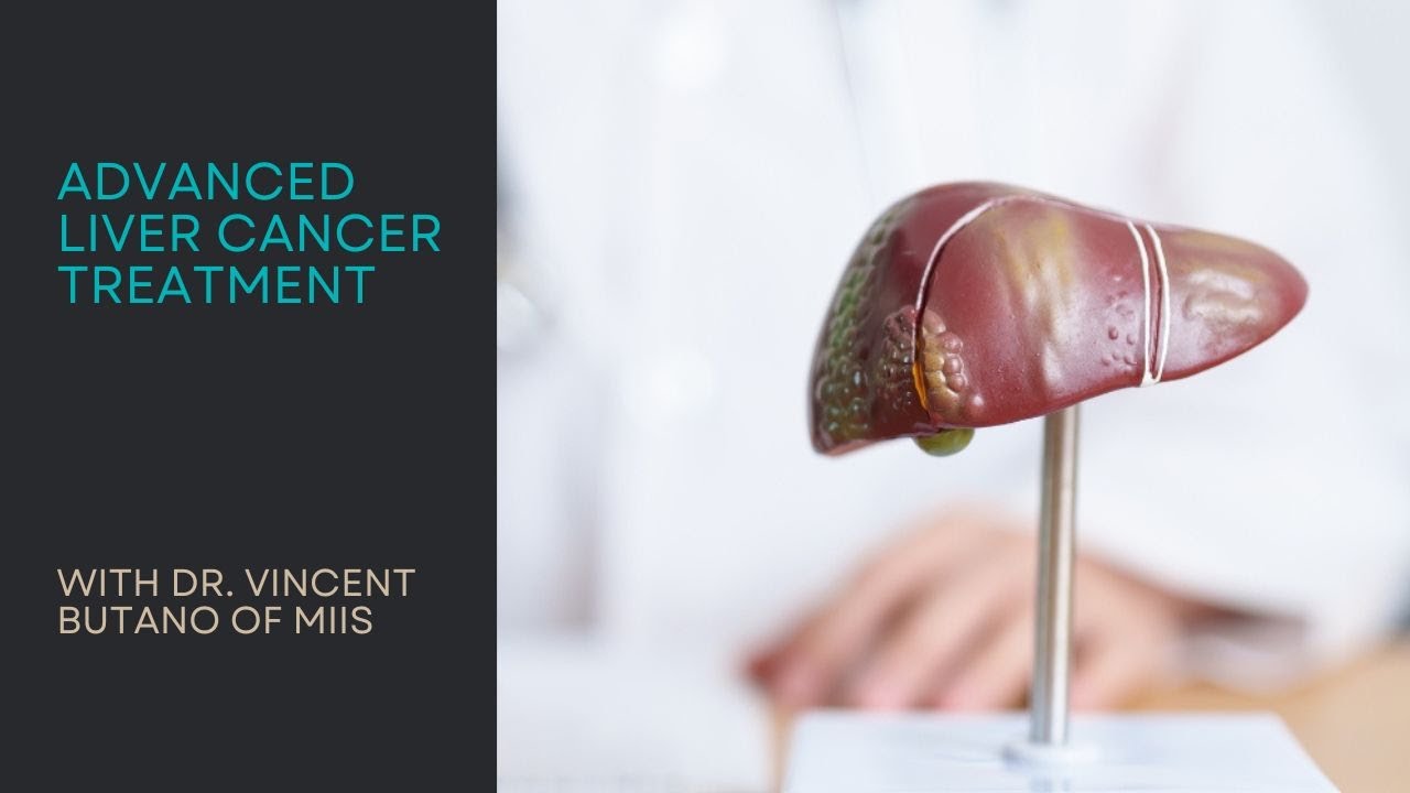 Advanced Liver Cancer Treatments at the Minimally Invasive Institute of Surgery
