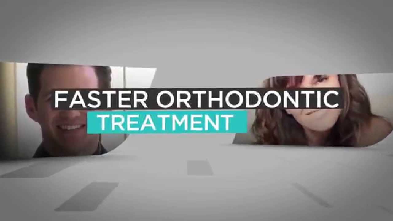 AcceleDent&reg; Aura - Now at Finn Orthodontics!