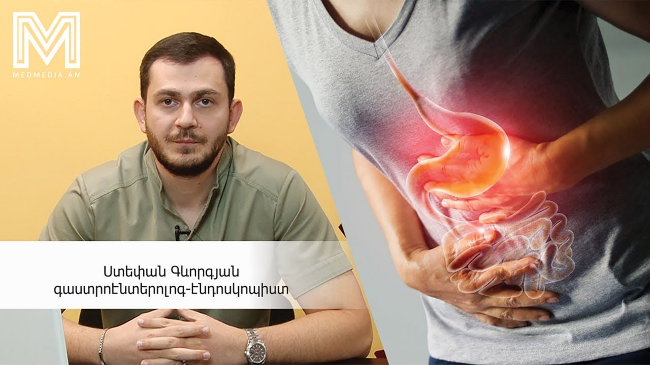 Երեք խորհուրդ բժշկից. ստամոքսի խոց #medmedia