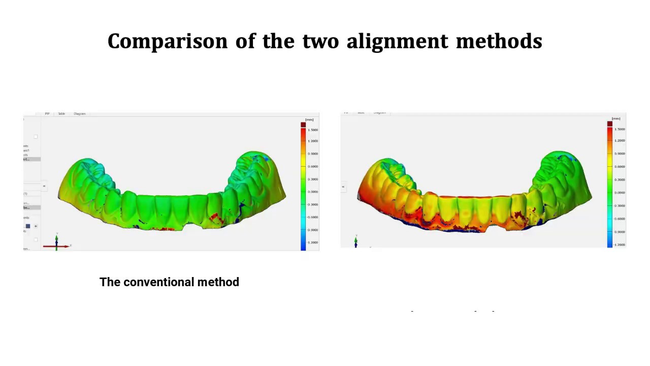 A novel method for complex three-dimensional evaluation of intraoral scanner accuracy.